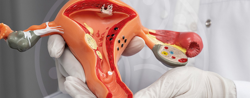 Imagem Cirurgia Ginecologica